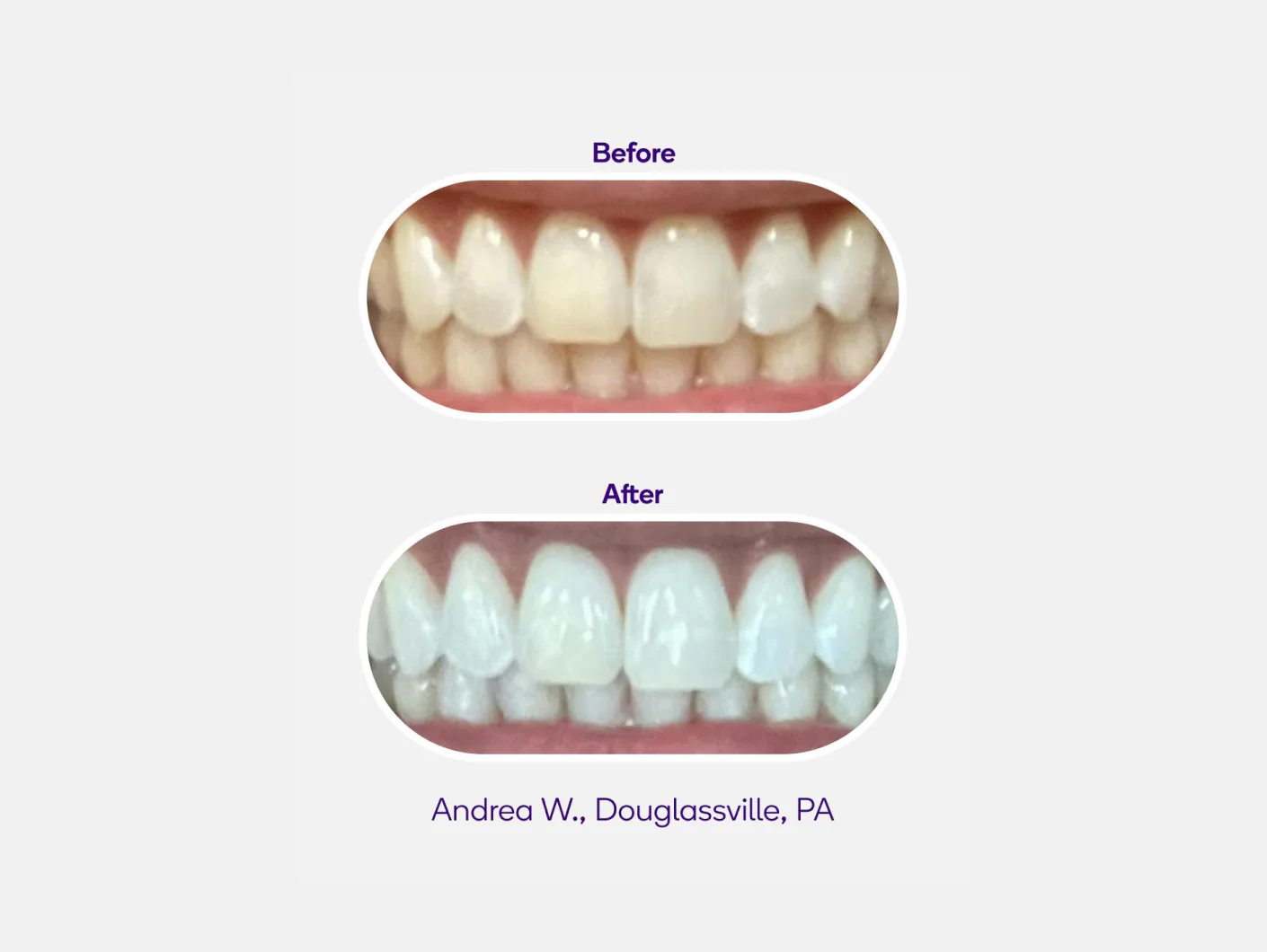 Non-Slip Whitening Strips - Image 4