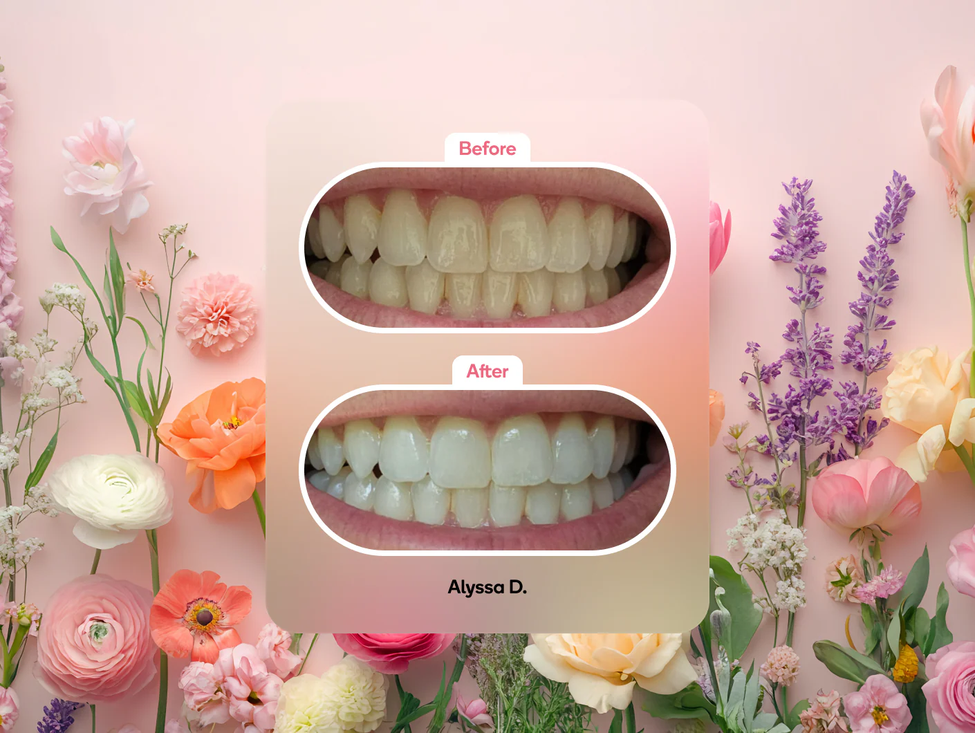 Precision Whitening Pen - Image 9